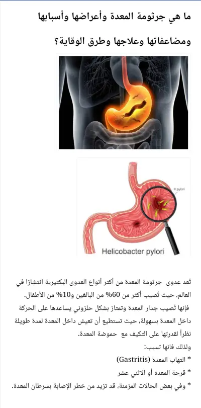 جرثومة المعدة