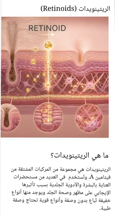 الريتينويدات