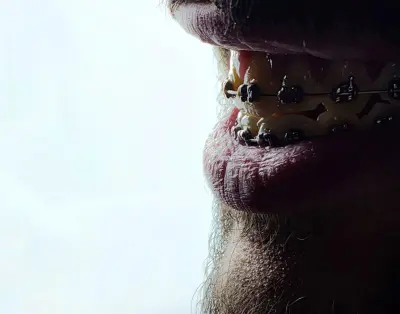 إعلانات لدكاترة طب أسنان