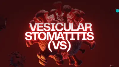 تصميم عرض تقديمي احترافي عن Vesicular Stomatitis (VS)