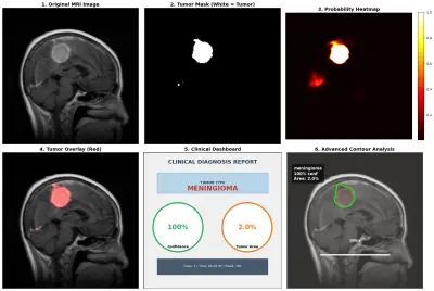 نظام ذكي للكشف عن أورام المخ من صور الرنين المغناطيسي (Brain Tumor MRI Classification & Segmentation)