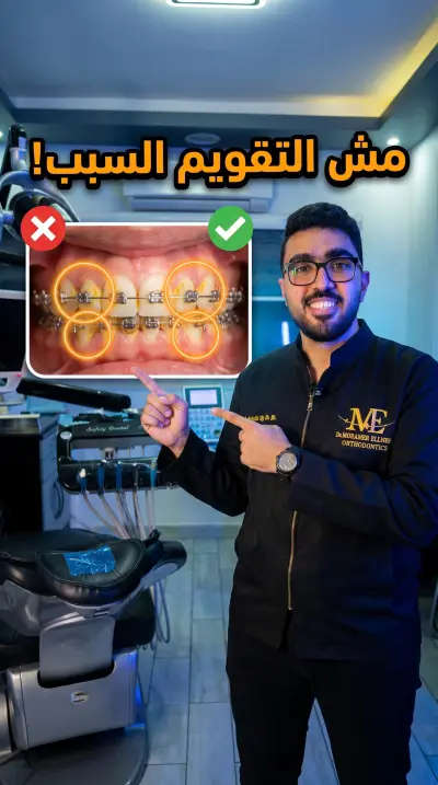 سلسه فيدوهات ب تاثيرات علي حسب طلب العميل لي دكتور تقويم