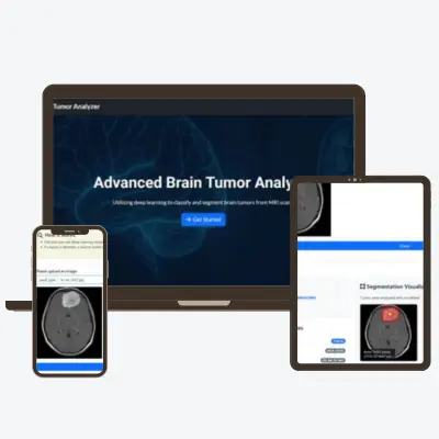 Brain Tumor Detection & Staging (: نظام ذكي للكشف عن أورام المخ وتصنيف مراحلها بدقة 99.7%)