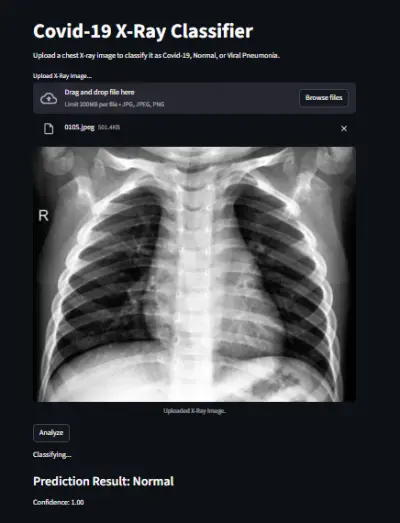 صورة العمل Covid-19 X-Ray Classification using CNN