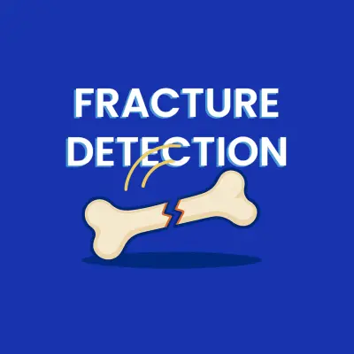 نموذج ذكاء اصطناعي لاكتشاف كسور العظام (X-ray Fracture Detection)