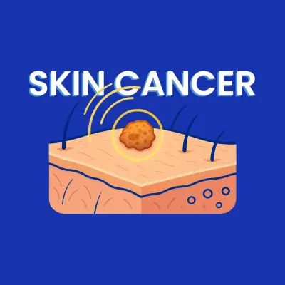 نموذج ذكاء اصطناعي لتشخيص سرطان الجلد (Skin Cancer Classification)