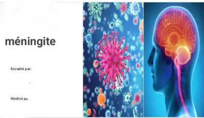 Présentation sur le maladie de méningite