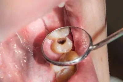 نموذج لمونتاج طبي