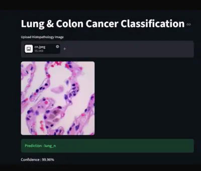 Lung & Colon Cancer Classification using Deep Learning