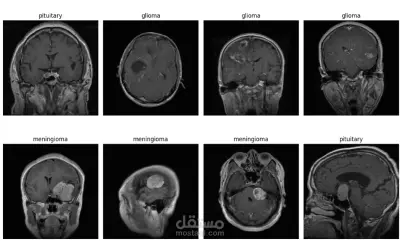 تصنيف أورام الدماغ من صور الرنين المغناطيسي (MRI) باستخدام الشبكات العصبية التلافيفية (CNN)
