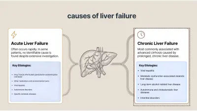 بوربوينت احترافي عن الفشل الكبدي باللغة الإنجليزية  liver failure