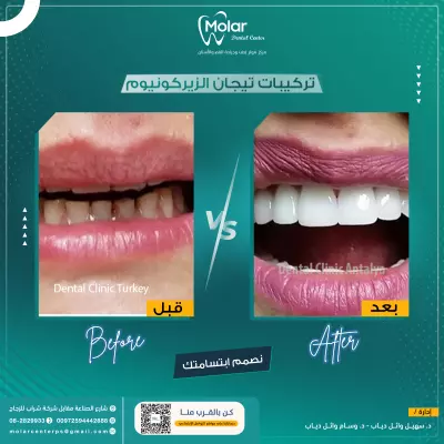 تصاميم متنوعة لـ عيادات أسنان