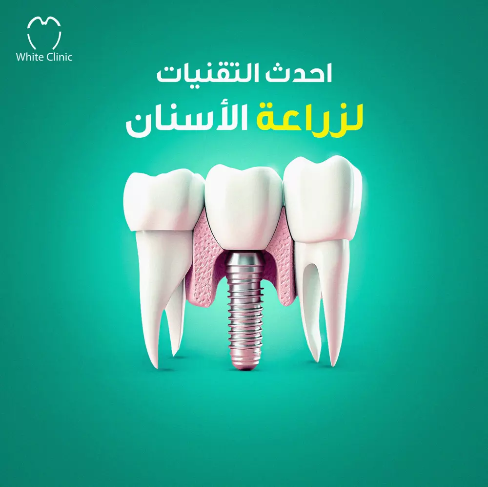 اقوم بتنفيذ تصميمات سوشال ميديا بشكل احترافي يضيف واجهة وشكل مميز لمنتجك ويساهم في عرضه بشكل يجذب العملاء