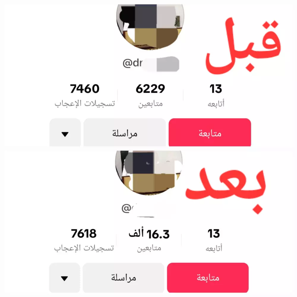 زيادة ورفع حسابك الي 10,000 متابع في الTik Tok