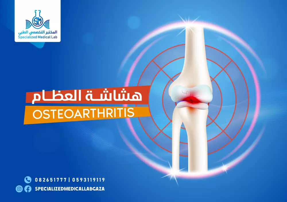 تصميم بوست احترافي ( 10 دولار فقط )