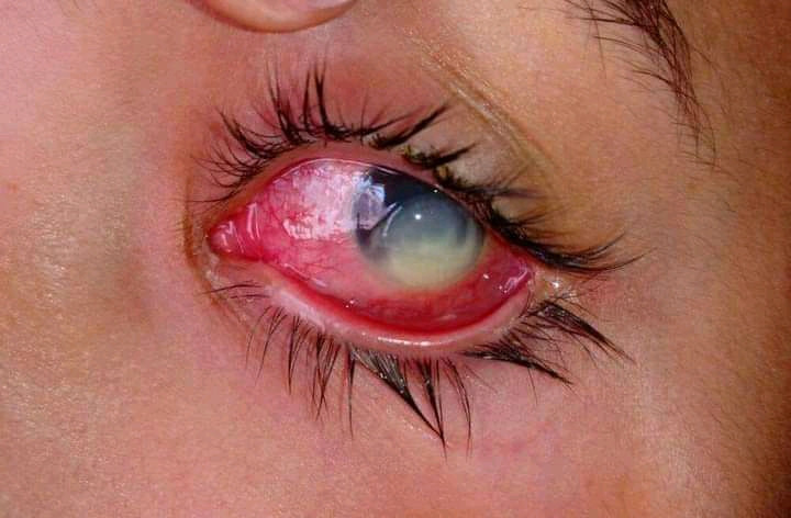 شرح كل ما يتعلق بمجال البصريات