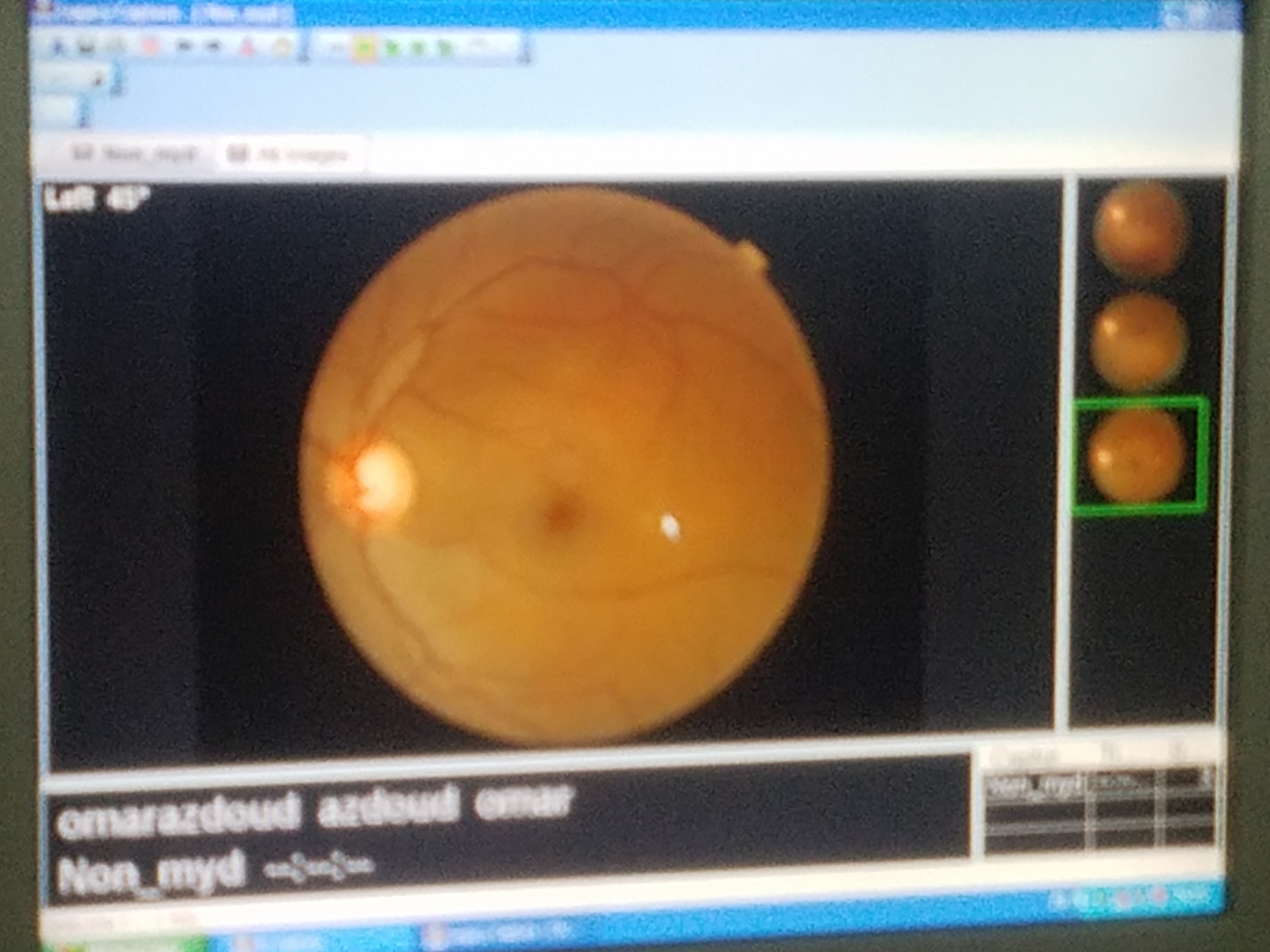 شرح كل ما يتعلق بمجال البصريات