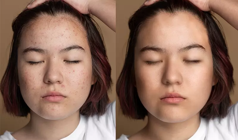 تعديل الصور الخاصه بك بشكل احترافي وبأعلي حودة