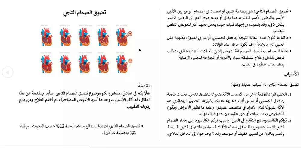 كتابة المقالات باللغة العربية