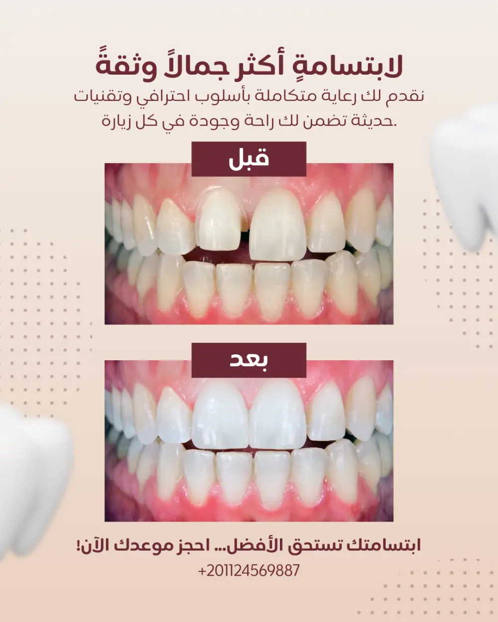 تصميم بوستات سوشيال ميديا احترافية جذابة لكل المجالات