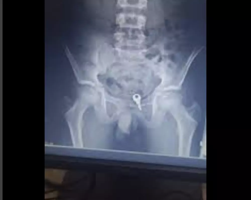 قراءة تقارير التحاليل والأشعه