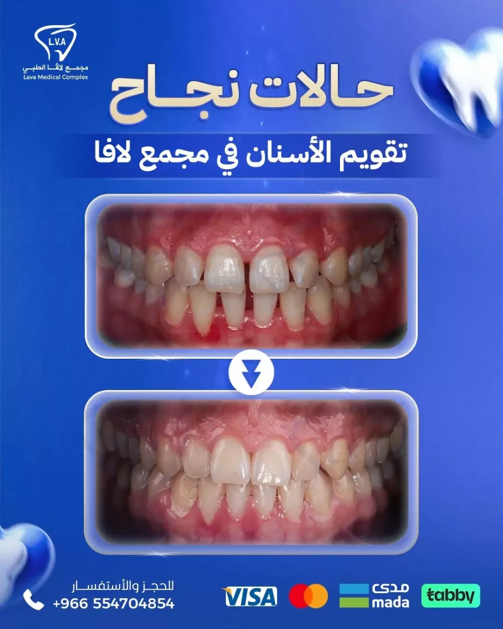 تصميمات سوشيال ميديا