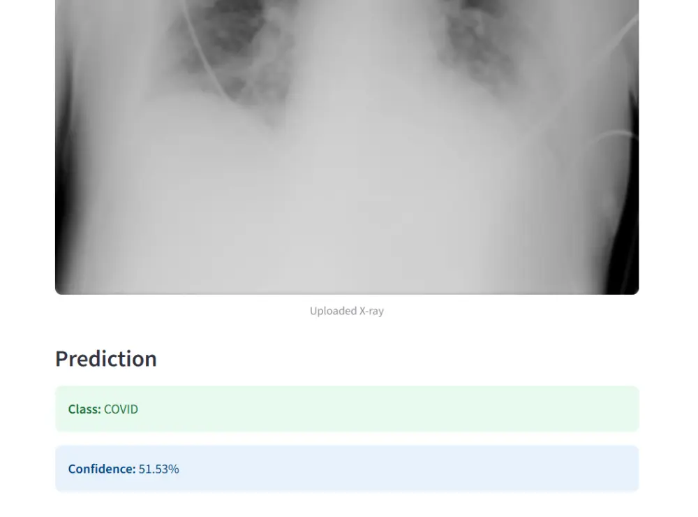 بناء نماذج ذكاء اصطناعي (تعلم الآلة / التعلم العميق) - معالجة بيانات