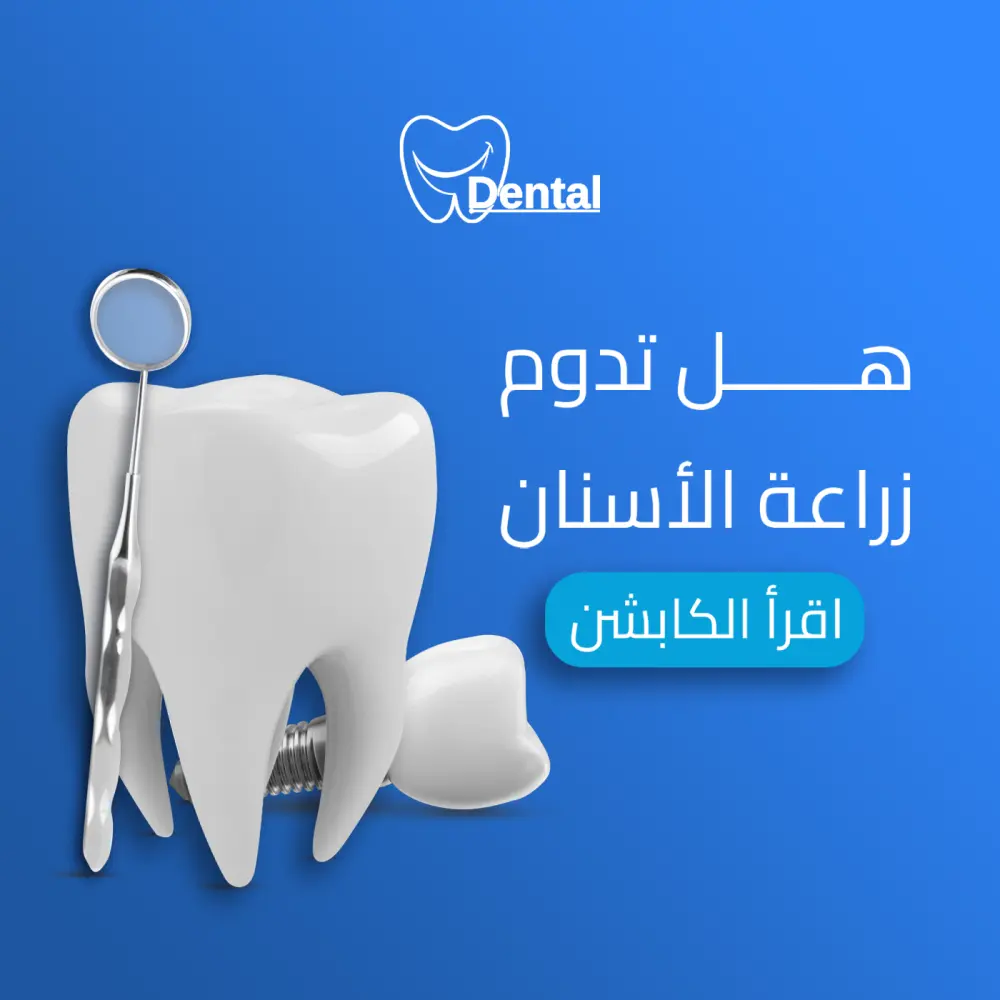 خدمة تصميم بوستات سوشيال ميديا (باقة 10 بوستات)