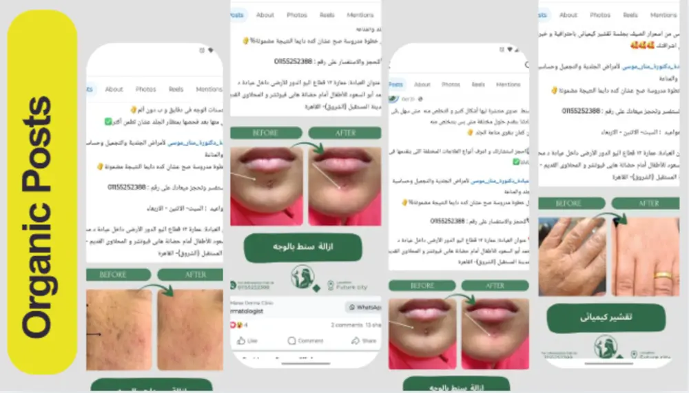 "Marketing Strategy: خطة تسويق احترافية لزيادة المبيعات ونمو