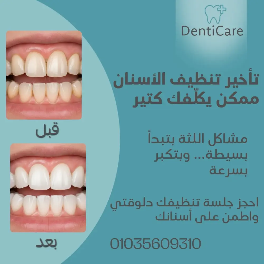 تصميم 3 بوستات احترافية لمنصات التواصل الاجتماعي (إنستغرام، فيسبوك)