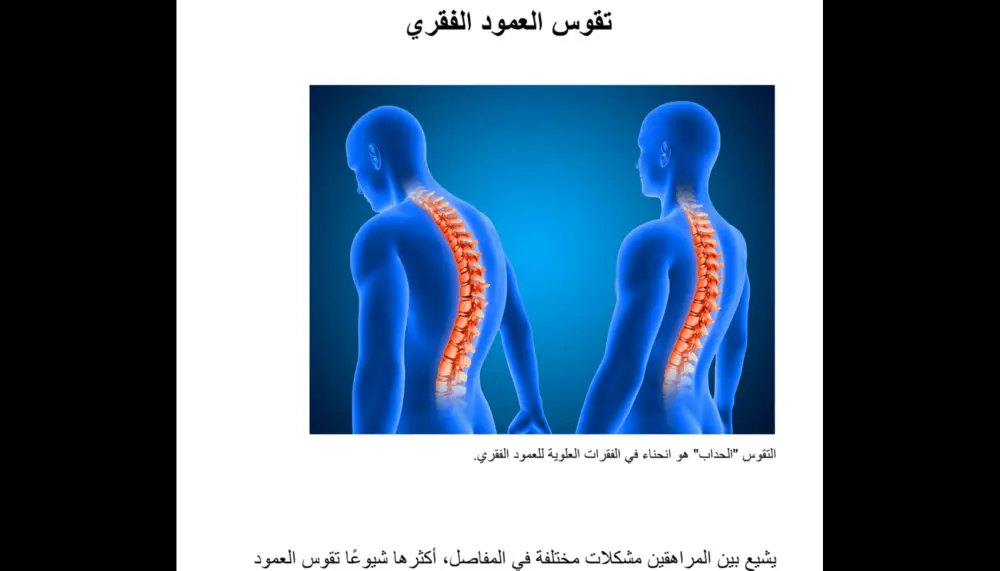 كتابة مقال احترافي متوافق مع السيو (SEO) بالعربية