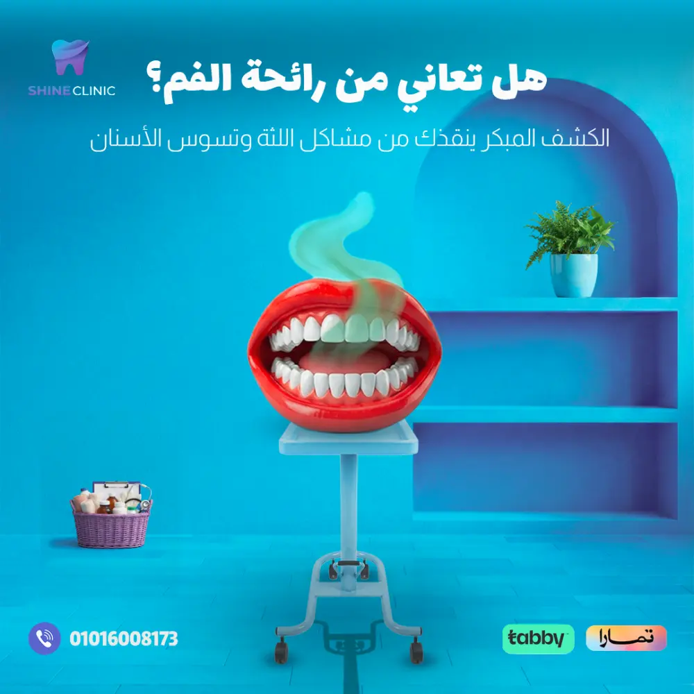 تصميم إعلان سوشيال ميديا جذاب يحل مشكلة ضعف التفاعل