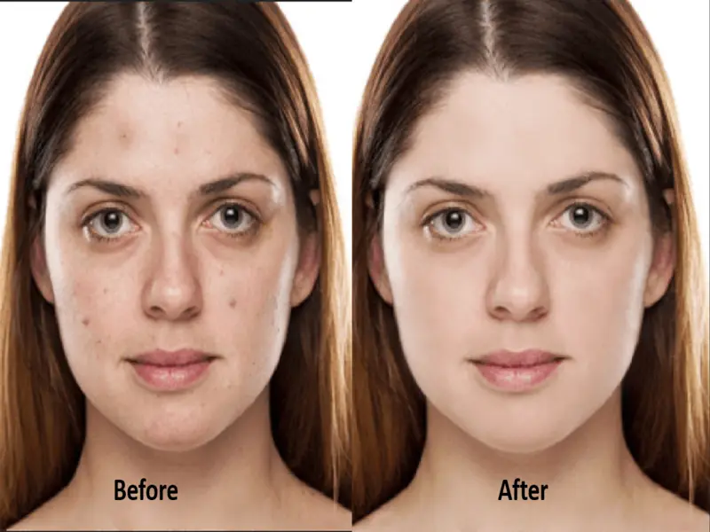تنقية ومعالجة البشرة باحتراف باستخدام Photoshop
