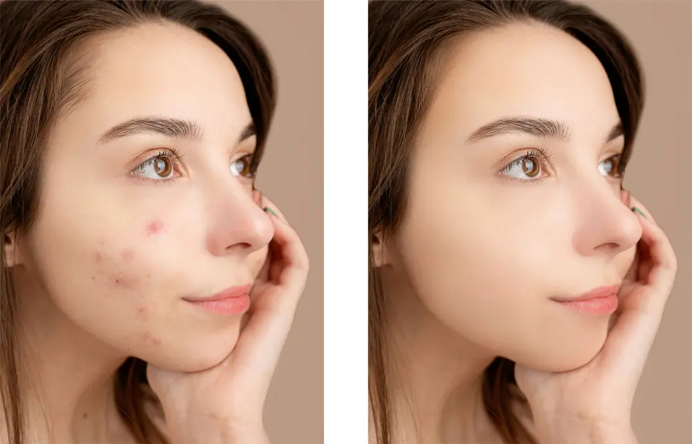 تحسين الصور باحتراف | تعديل الألوان والإضاءة والخلفية