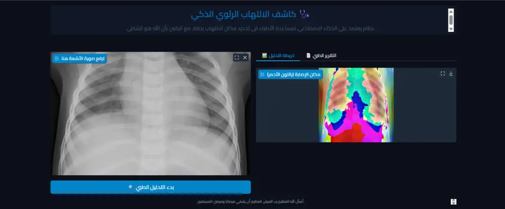 بناء نظام ذكاء اصطناعي (Deep Learning) للكشف عن الالتهاب الرئوي بالأشعة السينية.