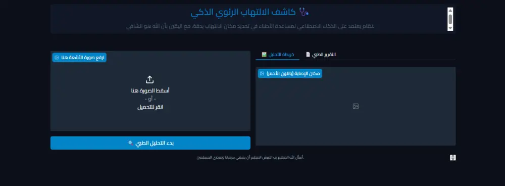 بناء نظام ذكاء اصطناعي (Deep Learning) للكشف عن الالتهاب الرئوي بالأشعة السينية.