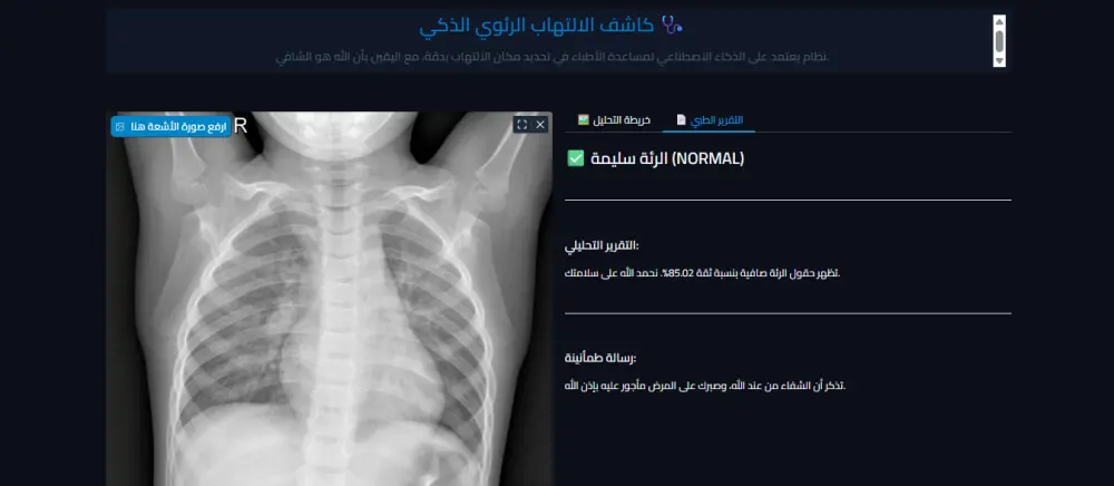 بناء نظام ذكاء اصطناعي (Deep Learning) للكشف عن الالتهاب الرئوي بالأشعة السينية.