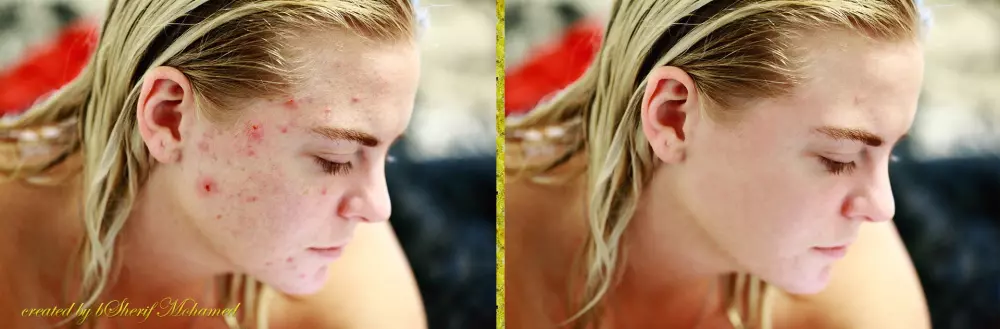 تعديل و تنميق الصور بتنعيم الجلد و إزالة التجاعيد و العيوب و بتبييض الأسنان