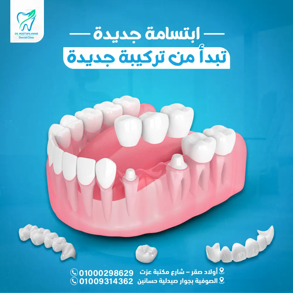 تصميم بوستات وإعلانات سوشيال ميديا احترافية تجذب العملاء