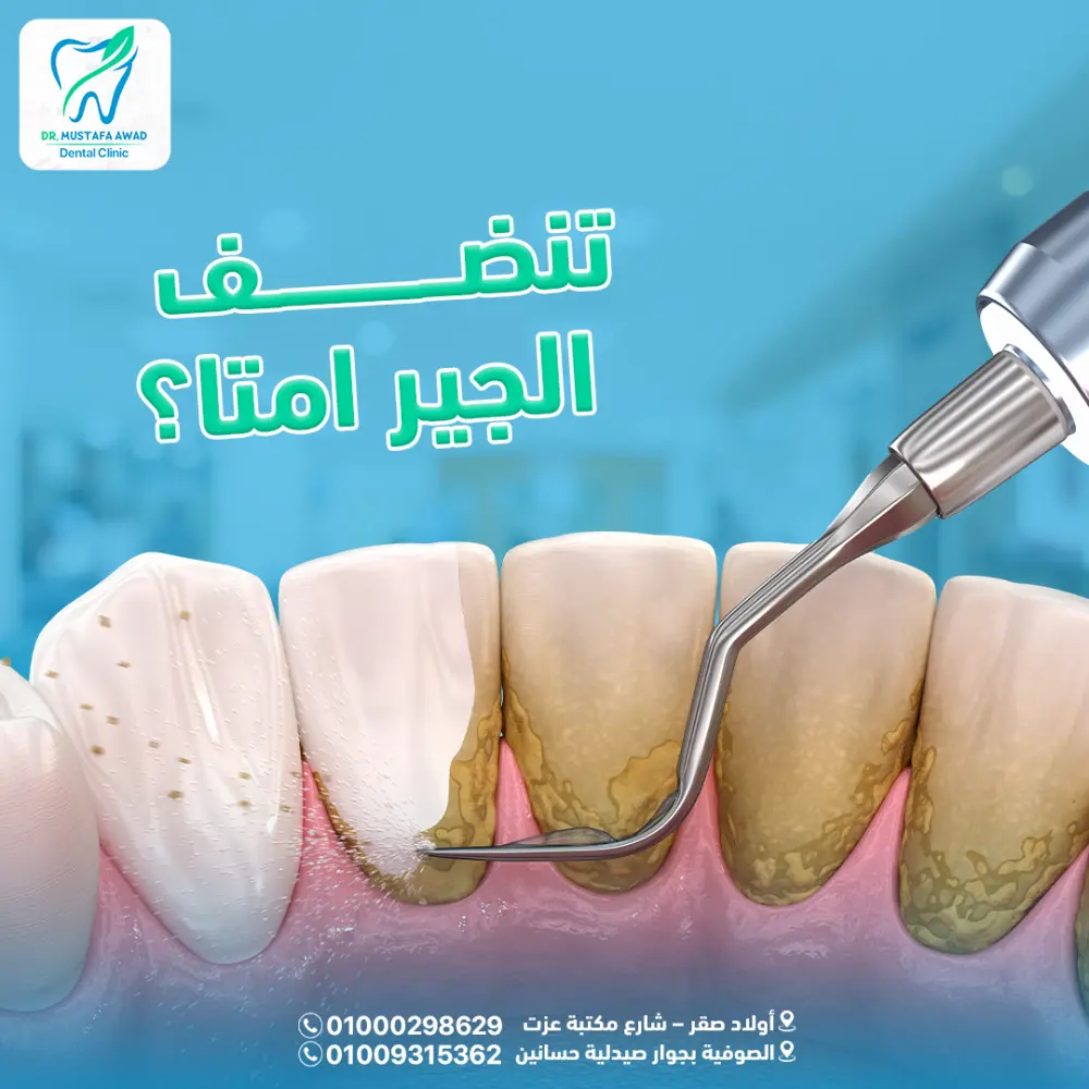 تصميم بوستات وإعلانات سوشيال ميديا احترافية تجذب العملاء