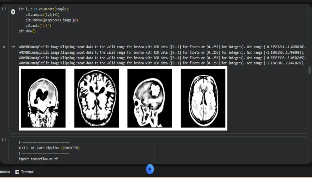 مشاريع تحليل الصور الطبية باستخدام الذكاء الاصطناعي (Medical Image Analysis with AI)