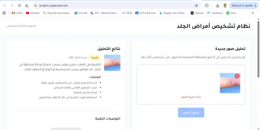 سأقوم ببناء وتطوير وتدريب نموذج ذكاء اصطناعي احترافي (AI Model) باستخدام Machine Learning وDeep Learning