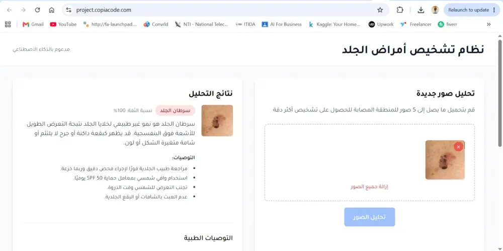 سأقوم ببناء وتطوير وتدريب نموذج ذكاء اصطناعي احترافي (AI Model) باستخدام Machine Learning وDeep Learning