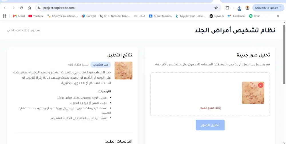 سأقوم ببناء وتطوير وتدريب نموذج ذكاء اصطناعي احترافي (AI Model) باستخدام Machine Learning وDeep Learning