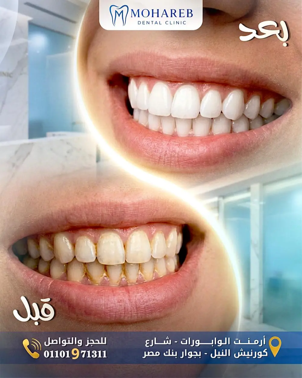 أصمم لك إعلانات سوشيال ميديا احترافية لعيادات الأسنان تساعدك في زيادة التفاعل، وبناء هوية بصرية قوية لعيادتك.
