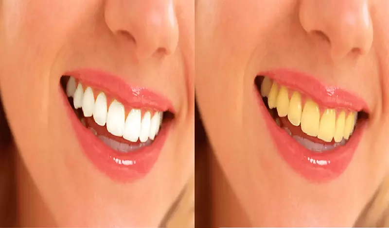 جميع التعديلات على الصور باحترافية وسرعة وجودة عالية