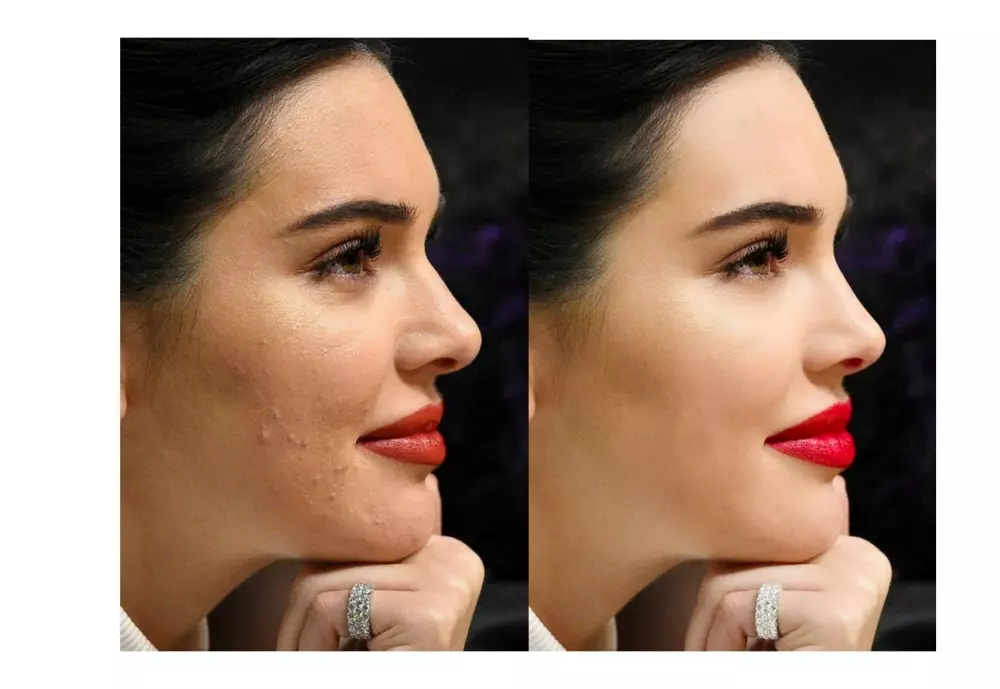 تعديل الصور