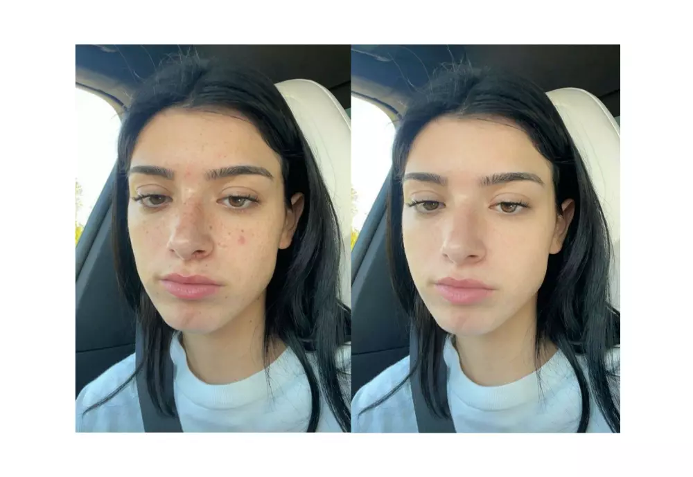 تعديل الصور