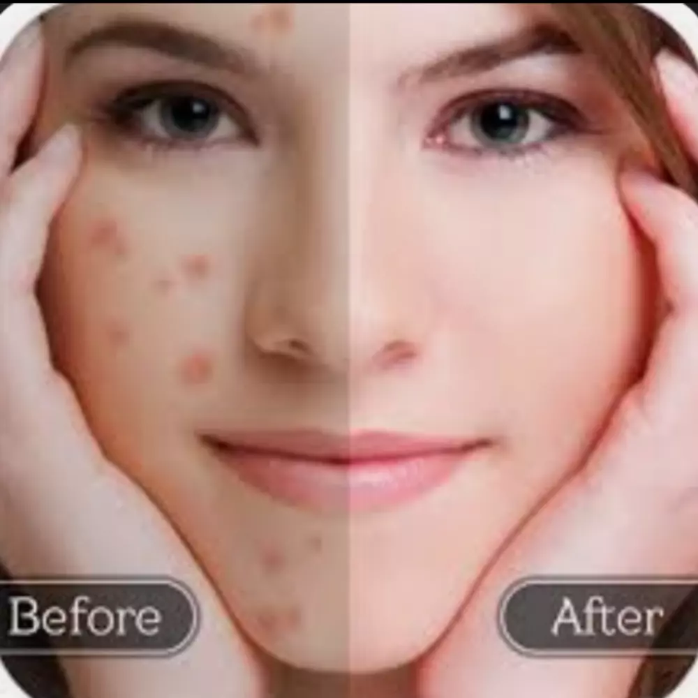 لفتره محدوده تعديل صورتان بي سعر صوره واحده