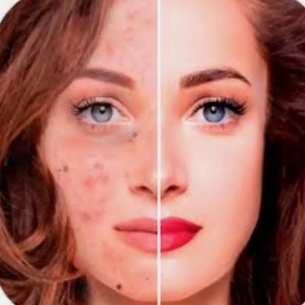 لفتره محدوده تعديل صورتان بي سعر صوره واحده